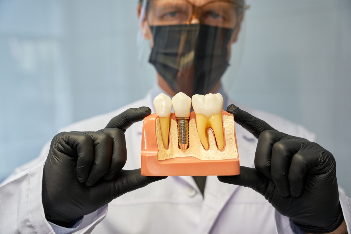 Dental Implants Austin