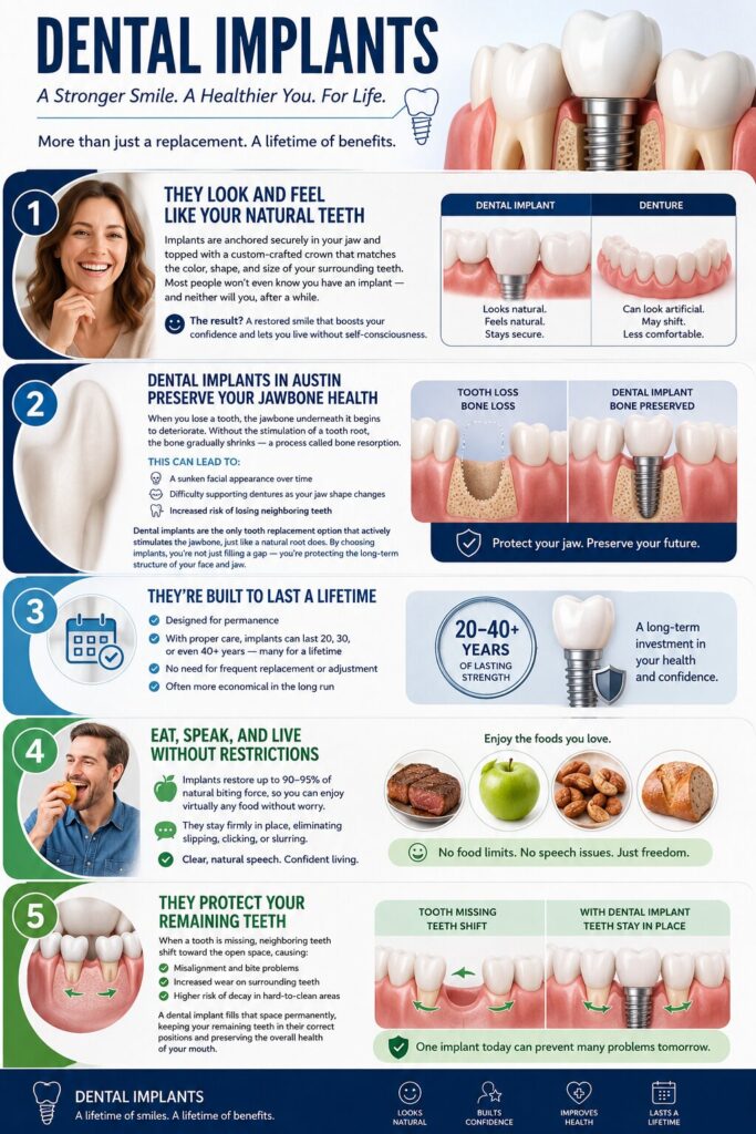 Dental Implants