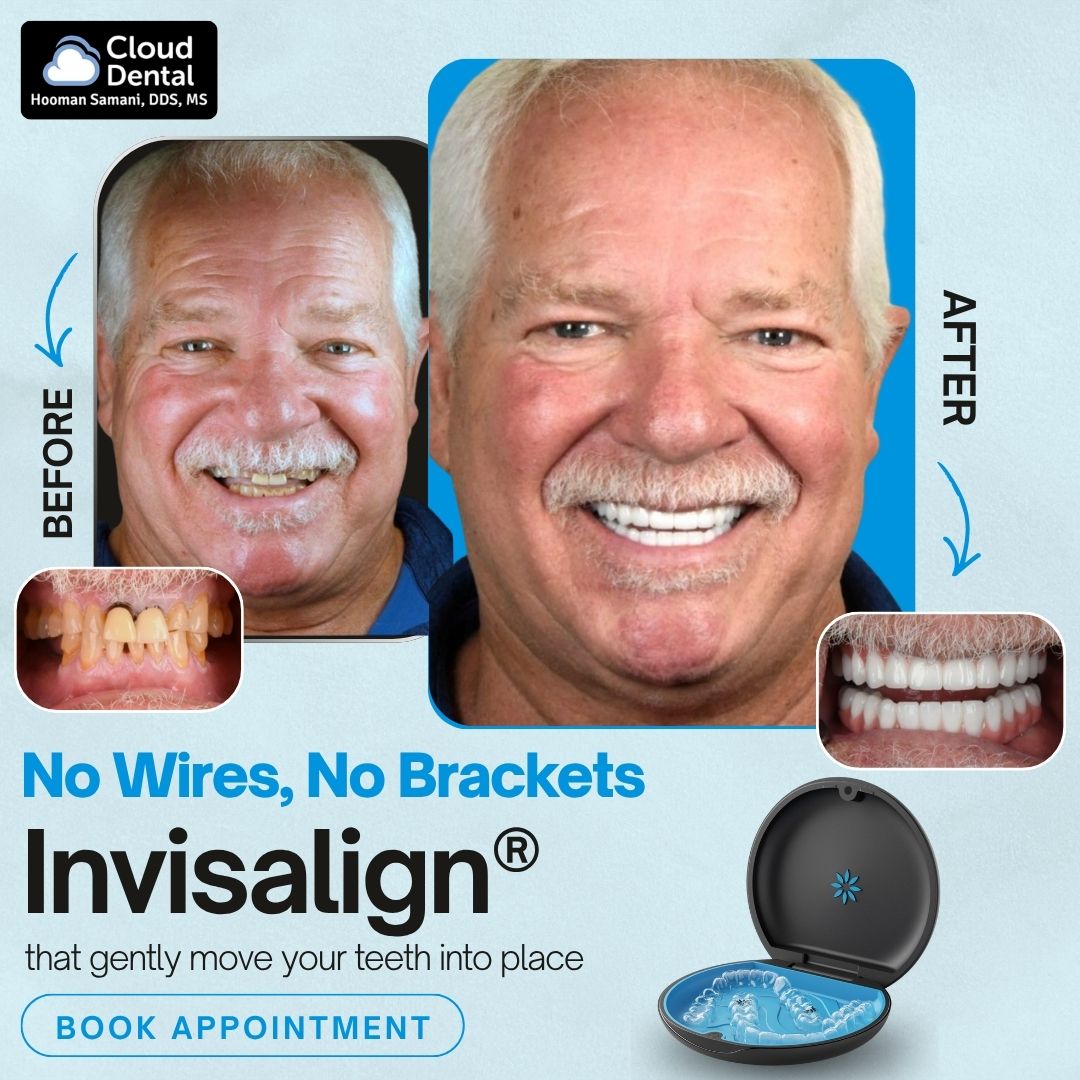 Invisalign before and after — Cloud Dental Austin patient results