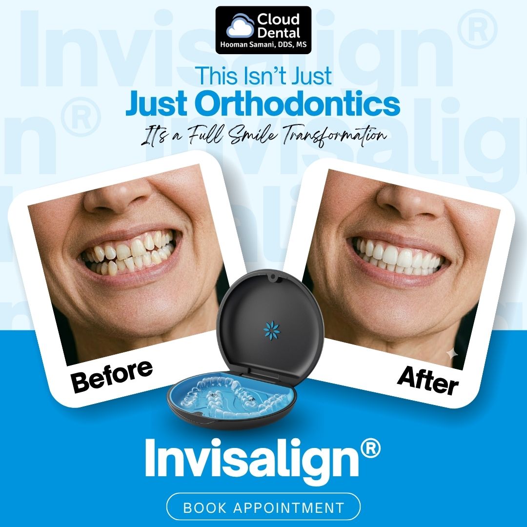Invisalign before and after — Cloud Dental Austin patient results