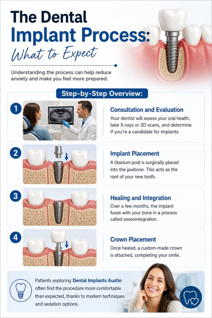 The Dental Implant Process: What to Expect